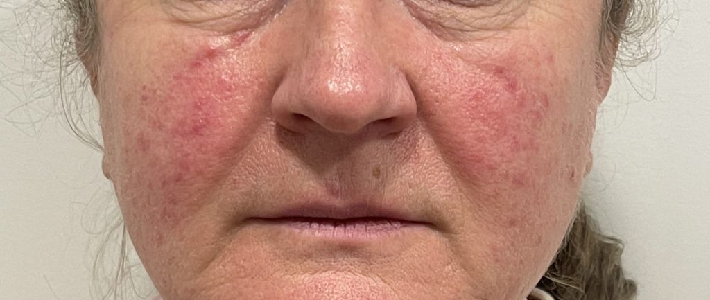 MARINA GENCHEVA (VASCULAR)_6